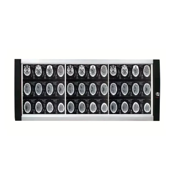 Triple-panel LED medical viewing box with 1080×425mm viewing area